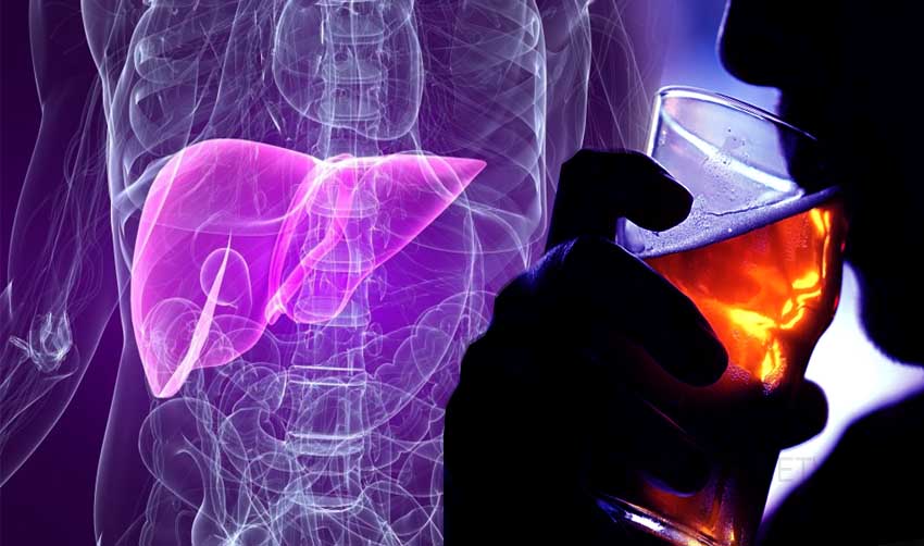 ആല്‍ക്കഹോളിക്ക് ഹെപ്പിറ്റൈറ്റിസ്